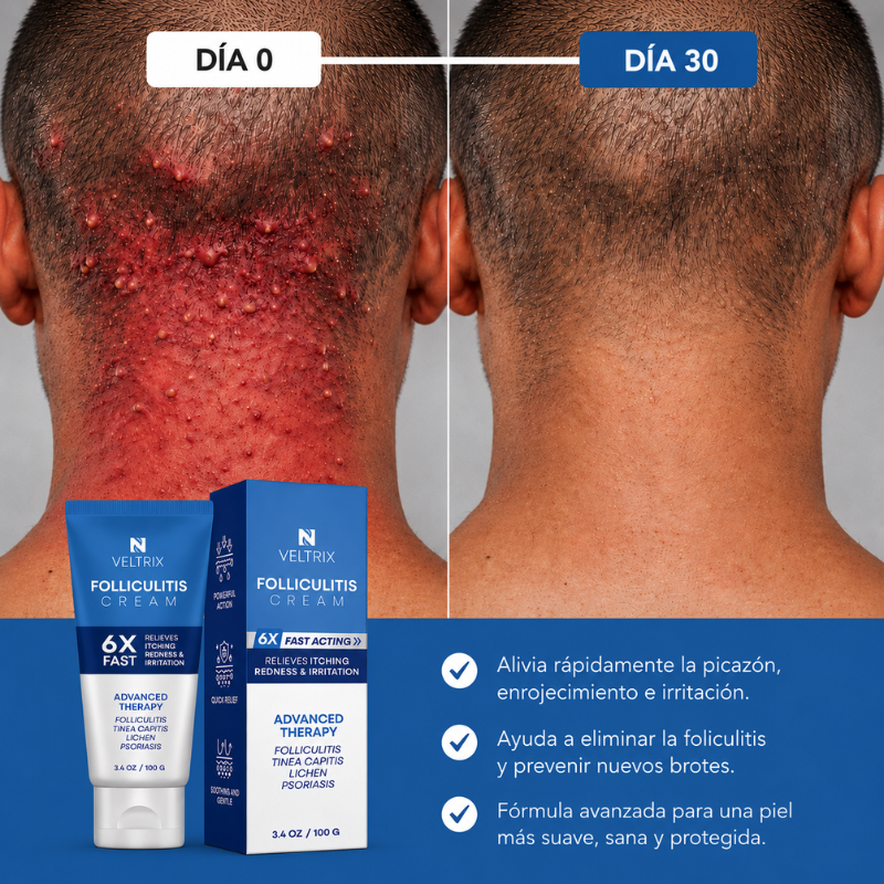 Veltrix™ Crema Intensiva Para Foliculitis