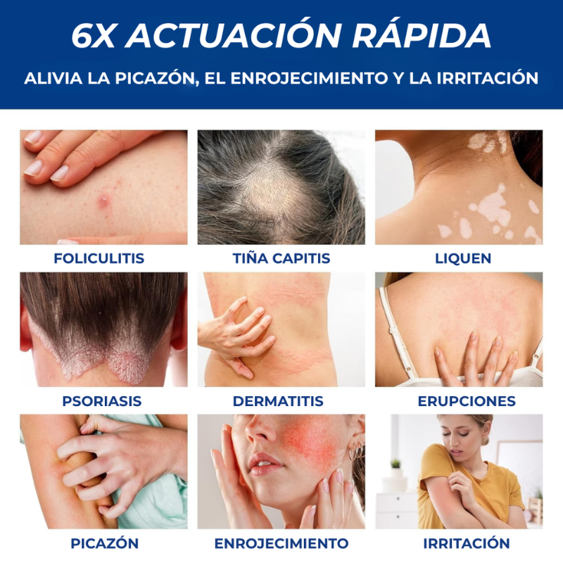 Veltrix™ Crema Intensiva Para Foliculitis